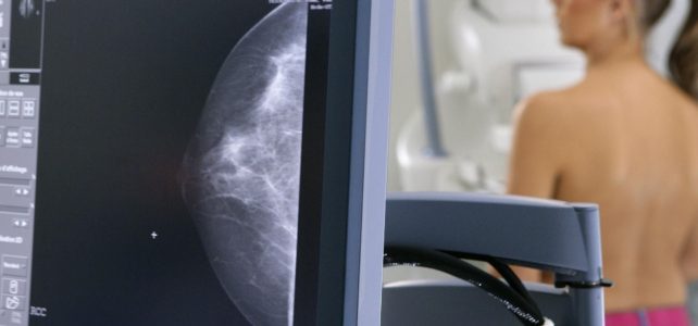 Информация о проведении в поликлинике Ивановского онкодиспансера Дня открытых дверей по ранней диагностике рака молочной железы.